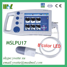 MSLPU17M Palm bladder scanner portable ultrasound machine